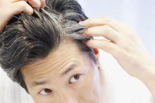5 cách khắc phục tóc bạc sớm ai cũng nên biết