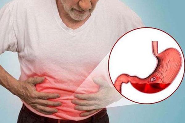 5 Thói quen gây bệnh dạ dày bạn nên tránh!