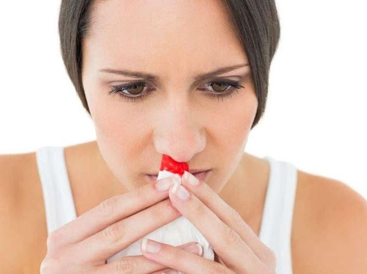 Để phòng ngừa tình trạng chảy máu cam, bạn cần giải tỏa căng thẳng và rèn luyện thói quen tốt