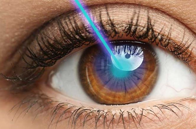 Mổ mắt cận bằng tia laser không đau đớn