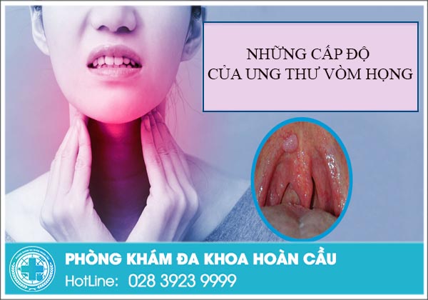 Ung thư vòm họng phát triển thành 4 giai đoạn rõ rệt
