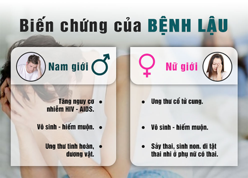Triệu chứng của bệnh lậu