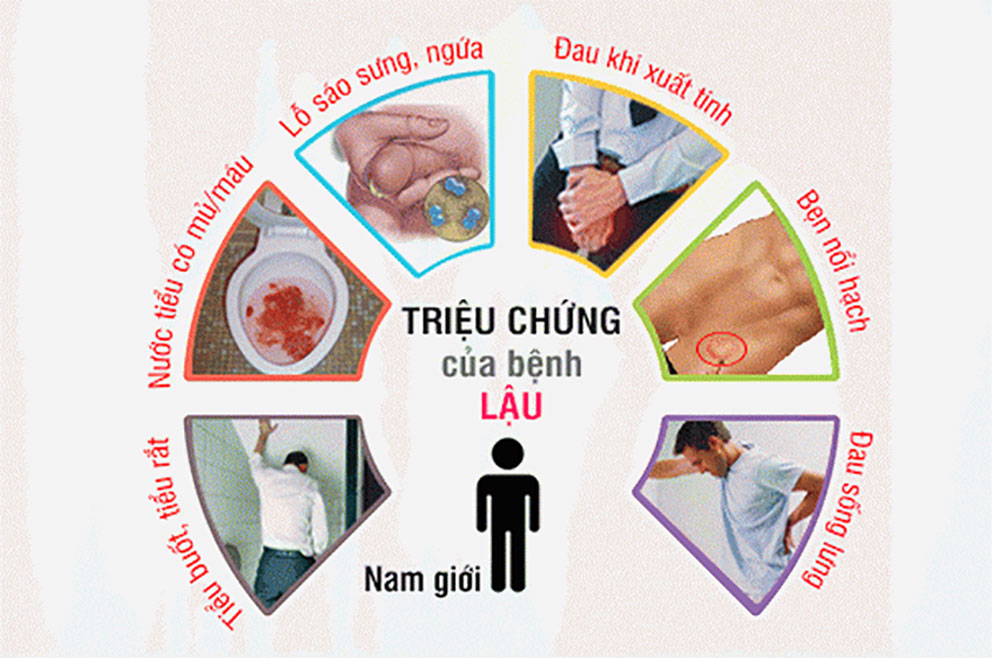 Điều trị bệnh lậu