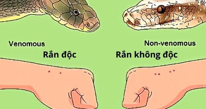 Tùy loại rắn mà vết cắn có dấu hiệu khác nhau