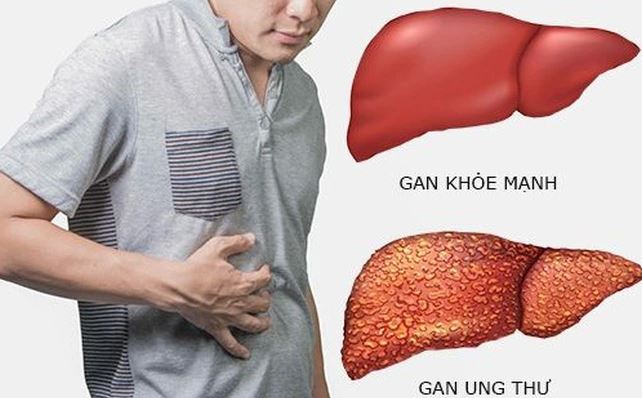 Dấu hiệu cảnh báo khi mắc bệnh như cơ thể bị đau tức vùng gan thường xuyên