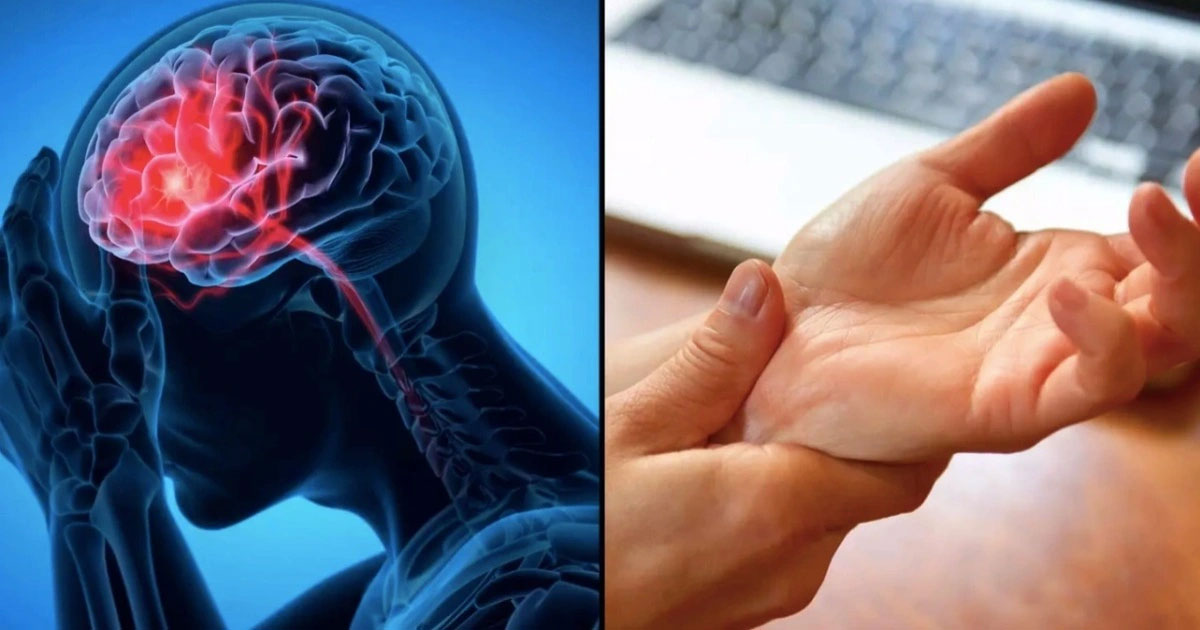 Các dấu hiệu khác của đột quỵ